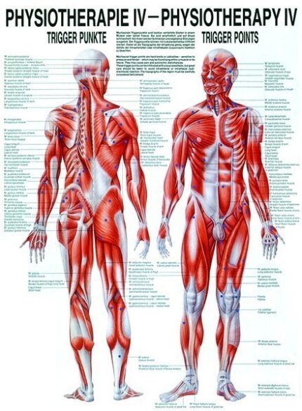 Anatomische Poster R IV / Triggerpoints 50 x 70 cm.  GELAMINEERD