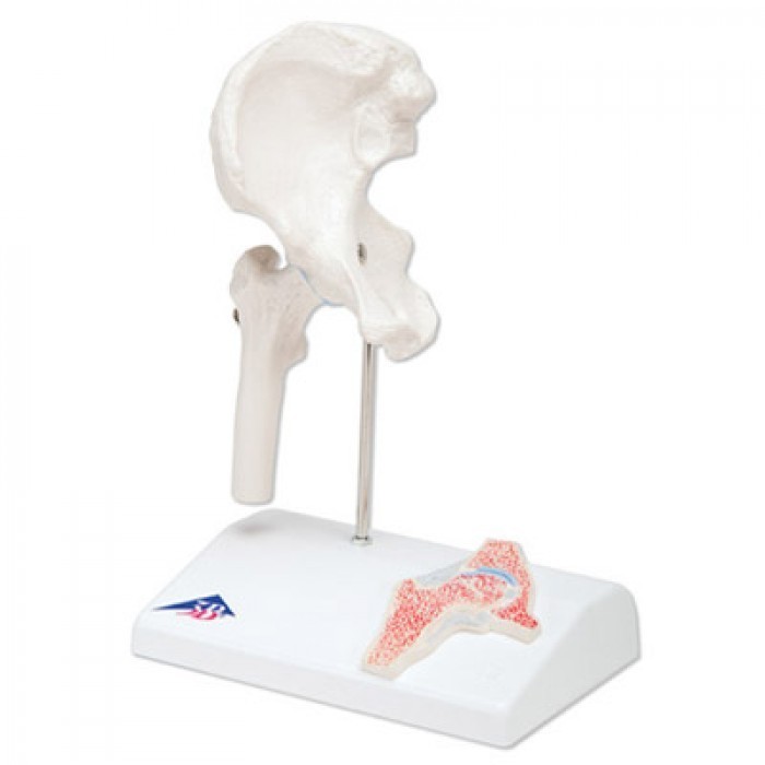 Anatomie Model Heup